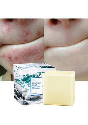 Soap with Sea Salt Natural Goat's Milk for Face Dry and Natural Oily Skin, Remove Acne Anti-cellulite Soap (3.52 Oz)